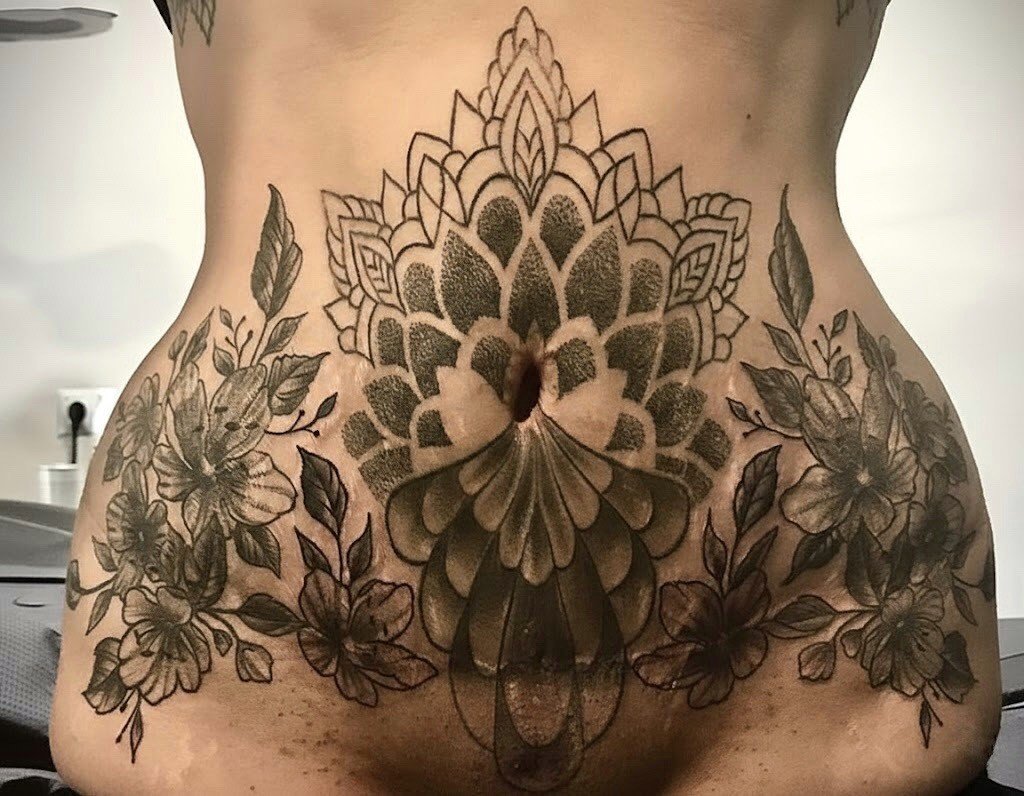 Tatuaje reparador y ornamental en piel con estrías y cicatrices.